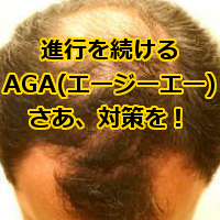 進行するAGA