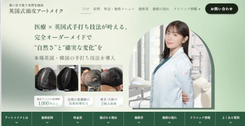 英国式頭皮アートメイク