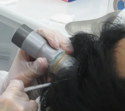 AGAスキンクリニックのDr’sメソ治療