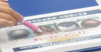 ゴリラクリニックの無料カウンセリング