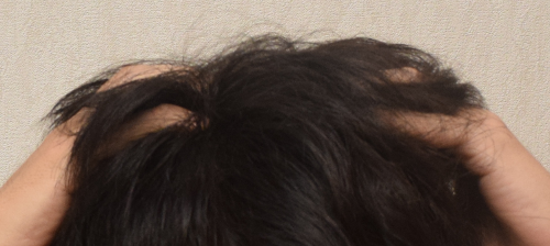 育毛剤ブブカ(BUBUKA)塗布後は頭皮全体をマッサージ