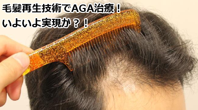 毛髪再生技術でAGA治療！いよいよ実現か？！