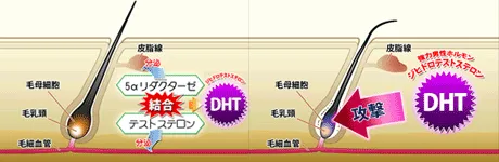 DHTとは ジヒドロテストステロンの略