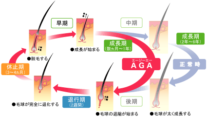 AGAと毛周期の関係