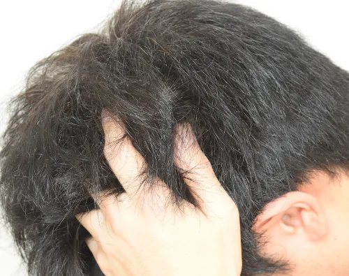 地肌をもみこむように丁寧にマッサージ