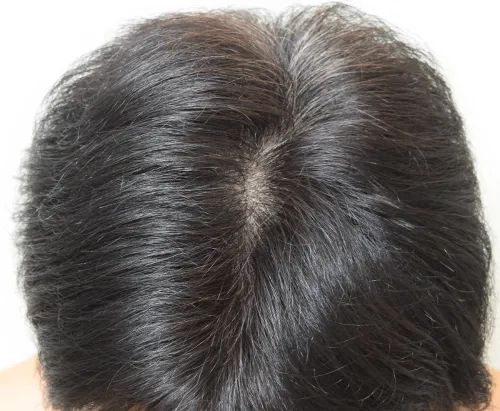 ヘアリプロの仕上がり