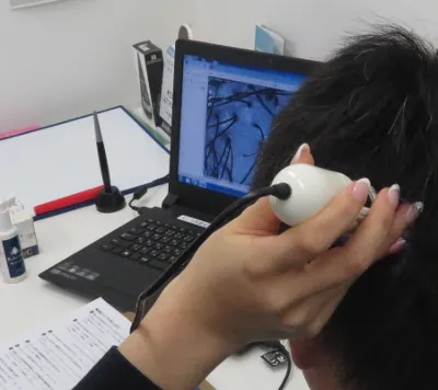 AGAスキンクリニックのカウンセラーによる頭皮の状態をチェック