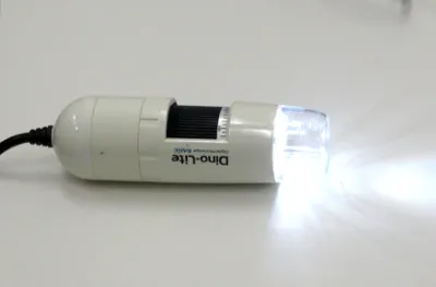 頭皮の状態をチェックするDino-Lite