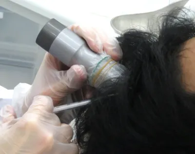 AGAスキンクリニックのDr.メソ体験