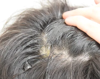 MONOVOヘアトニックグロウジェルの特徴