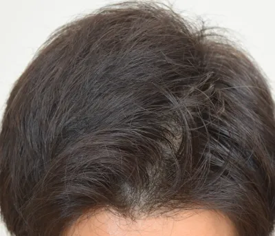 MONOVOヘアトニックグロウジェルの効果