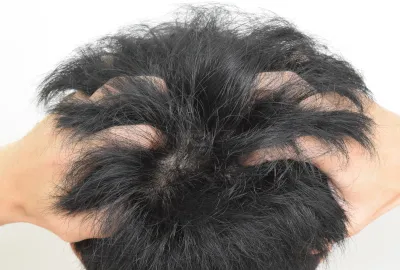 THE SCALP 5.0Cを塗布したら1分程度の頭皮マッサージする