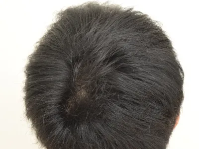 THE SCALP 5.0Cの使用後は艶やかな髪に仕上がった